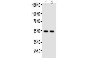 Anti-NFkB p100/p52 antibody,  Western blotting Lane 1: HELA Cell Lysate Lane 2: JURKAT Cell Lysate