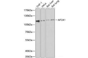 Western blot analysis of extracts of various cell lines using AP2A1 Polyclonal Antibody at dilution of 1:1000. (alpha Adaptin Antikörper)