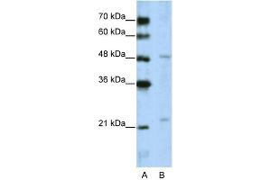 WB Suggested Anti-WDR12 Antibody Titration:  5.