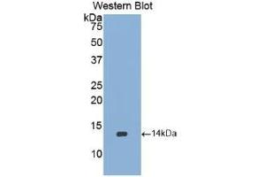 Western blot analysis of the recombinant protein. (BMP2 Antikörper  (AA 284-388))