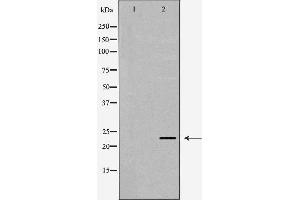Western blot analysis of extracts of SW480, using LCN2 antibody.