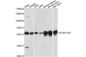 Western blot analysis of extracts of various cell lines, using ATP6V1B2 Antibody (ABIN5971942) at 1/1000 dilution. (ATP6V1B2 Antikörper)