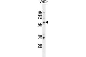Western Blotting (WB) image for anti-beta-Carotene 15,15'-Monooxygenase 1 (BCMO1) antibody (ABIN2995663) (BCMO1 Antikörper)