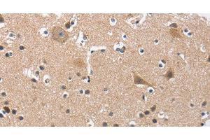 Immunohistochemistry of paraffin-embedded Human brain tissue using BUB1 Polyclonal Antibody at dilution 1:50 (BUB1 Antikörper)