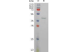 SDS-PAGE (SDS) image for Resistin (RETN) (AA 19-108) protein (Fc Tag) (ABIN7491199)