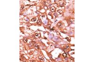 Image no. 2 for anti-Signal Transducer and Activator of Transcription 5A (STAT5A) (pSer726) antibody (ABIN358237) (STAT5A Antikörper  (pSer726))