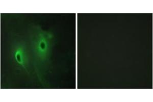 Immunofluorescence analysis of HeLa cells, using DUSP9 Antibody .