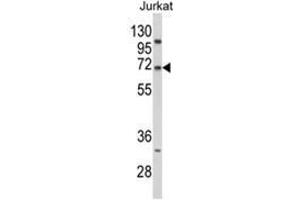 Western blot analysis of PCSK9 Antibody (N-term) in Jurkat cell line lysates (35ug/lane). (PCSK9 Antikörper  (N-Term))