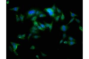 Immunofluorescence staining of HepG2 cells with ABIN7173996 at 1:100, counter-stained with DAPI. (YARS Antikörper  (AA 2-528))