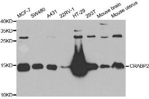 Western Blotting (WB) image for anti-Cellular Retinoic Acid Binding Protein 2 (CRABP2) antibody (ABIN1882301) (CRABP2 Antikörper)