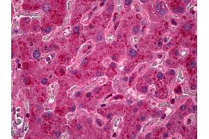 Immunohistochemistry (IHC) image for anti-Lactate Dehydrogenase A (LDHA) antibody (ABIN957729)