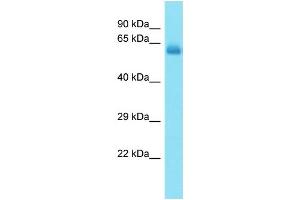 Host: Rabbit Target Name: CCDC155 Sample Type: Fetal Heart lysates Antibody Dilution: 1. (CCDC155 Antikörper  (C-Term))