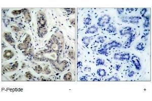 Image no. 1 for anti-BCL2-Associated Agonist of Cell Death (BAD) (pSer136), (pSer99) antibody (ABIN318335) (BAD Antikörper  (pSer99, pSer136))