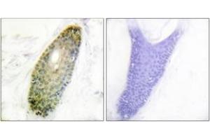 Immunohistochemistry analysis of paraffin-embedded human skin, using HDAC3 (Phospho-Ser424) Antibody. (HDAC3 Antikörper  (pSer424))