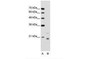 Image no. 1 for anti-Ubiquitin-Conjugating Enzyme E2D 1 (UBE2D1) (AA 91-140) antibody (ABIN203473)