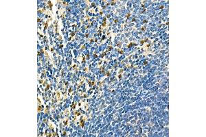 Immunohistochemistry of paraffin embedded mouse spleen using CD42d (ABIN7074111) at dilution of 1:700 (400x lens) (GP5 Antikörper)