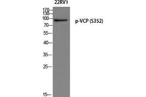 Western Blot (WB) analysis of 22RV1 using p-VCP (S352) antibody.
