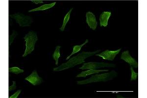 Immunofluorescence of monoclonal antibody to P2RY1 on HeLa cell. (P2RY1 Antikörper  (AA 1-52))