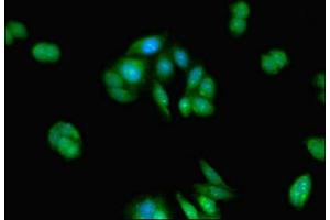 Immunofluorescent analysis of HepG2 cells using ABIN7159092 at dilution of 1:100 and Alexa Fluor 488-congugated AffiniPure Goat Anti-Rabbit IgG(H+L) (TMEM67 Antikörper  (AA 241-500))