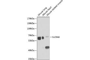 Western blot analysis of extracts of various cell lines, using SLC9 antibody (ABIN6131139, ABIN6148056, ABIN6148057 and ABIN6224211) at 1:1000 dilution. (SLC9A6 Antikörper  (AA 542-701))