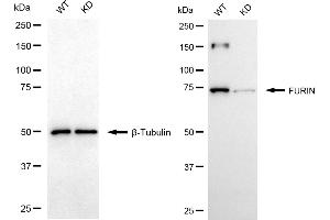 Western blotting analysis using FURIN antibody (ABIN7798668).