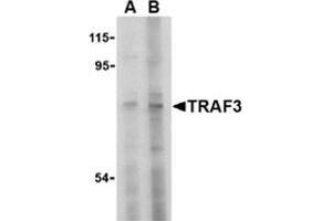 Western blot analysis of TRAF3 in HeLa cell lysate with this product at (A) 2 and (B) 4 μg/ml.