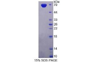 SDS-PAGE analysis of Rat PDE3A Protein. (PDE3A Protein)
