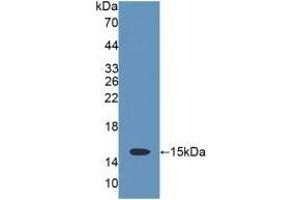 Detection of Recombinant CD7, Rat using Polyclonal Antibody to Cluster Of Differentiation 7 (CD7) (CD7 Antikörper  (AA 23-128))