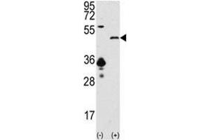 Western blot analysis of SIRT7 antibody and 293 cell lysate (2 ug/lane) either nontransfected (Lane 1) or transiently transfected with the SIRT7 gene (2). (SIRT7 Antikörper  (AA 331-360))