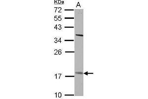 WB Image Sample (30 ug of whole cell lysate) A: H1299 12% SDS PAGE antibody diluted at 1:500 (PNPLA4 Antikörper)