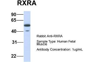 Host:  Rabbit  Target Name:  RXRA  Sample Type:  Human Fetal Muscle  Antibody Dilution:  1. (Retinoid X Receptor alpha Antikörper  (N-Term))