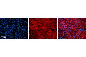 Rabbit Anti-Snf8 Antibody    Formalin Fixed Paraffin Embedded Tissue: Human Adult liver  Observed Staining: Cytoplasmic Primary Antibody Concentration: 1:100 Secondary Antibody: Donkey anti-Rabbit-Cy2/3 Secondary Antibody Concentration: 1:200 Magnification: 20X Exposure Time: 0.