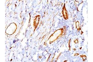 Image no. 1 for anti-CD34 (CD34) antibody (ABIN6185925) (CD34 Antikörper)