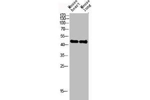 Western Blot analysis of mouse-heart mouse-lung cells using Actin α3 Polyclonal Antibody (ACTG2 Antikörper  (N-Term))