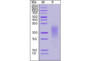 Human ALK-7, His Tag on  under reducing (R) condition. (ACVR1C/ALK7 Protein (AA 21-113) (His tag))