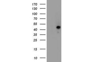 Western Blotting (WB) image for anti-serpin Peptidase Inhibitor, Clade A (Alpha-1 Antiproteinase, Antitrypsin), Member 5 (SERPINA5) antibody (ABIN1500054) (SERPINA5 Antikörper)