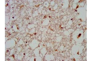 IHC image of ABIN7165031 diluted at 1:600 and staining in paraffin-embedded human brain tissue performed on a Leica BondTM system. (GNAS Antikörper  (AA 310-404))
