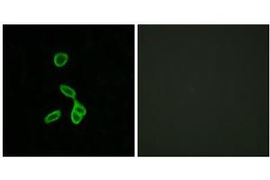 Immunofluorescence analysis of LOVO cells, using GALR1 antibody. (Galanin Receptor 1 Antikörper  (Internal Region))