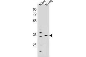 Western Blotting (WB) image for anti-Potassium Channel Regulator (KCNRG) antibody (ABIN2995148) (KCNRG Antikörper)