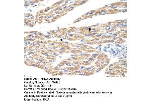 Human Muscle (TNRC5 Antikörper  (C-Term))
