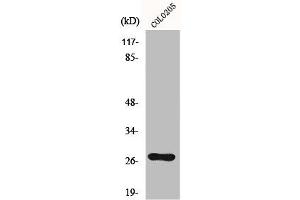Western Blot analysis of Colo205 cells using OTUB2 Polyclonal Antibody (OTUB2 Antikörper  (Internal Region))
