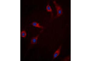 Immunofluorescent analysis of RRAD staining in HepG2 cells. (RRAD Antikörper  (Center))