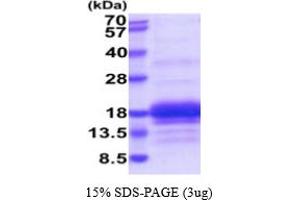 SDS-PAGE (SDS) image for CD3g Molecule, gamma (CD3-TCR Complex) (CD3G) (AA 23-116) protein (His tag) (ABIN6387995)