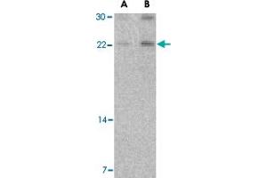 Western blot analysis of CBLN1 in mouse cerebellum tissue lysate with CBLN1 polyclonal antibody  at (A) 2 and (B) 4 ug/mL . (CBLN1 Antikörper  (Internal Region))