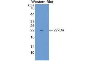 Western blot analysis of the recombinant protein. (Cytokeratin 18 Antikörper  (AA 1-159))