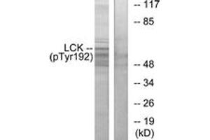 Western blot analysis of extracts from Jurkat cells, using Lck (Phospho-Tyr192) Antibody. (LCK Antikörper  (pTyr192))