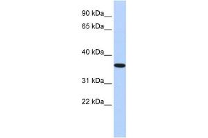 WB Suggested Anti-CPXCR1 Antibody Titration: 1 ug/ml Positive Control: Fetal Brain Lysate (CPXCR1 Antikörper  (Middle Region))