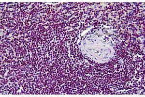 Human Spleen: Formalin-Fixed, Paraffin-Embedded (FFPE) (CDK6 Antikörper  (AA 3-100))