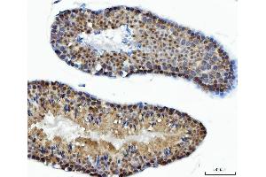 IHC analysis of ACLY using anti-ACLY antibody (ABIN4886416). (ACLY Antikörper  (AA 1-180))