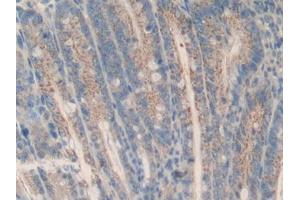 DAB staining on IHC-P; Samples: Mouse Intestine Tissue (MCL-1 Antikörper  (AA 2-307))